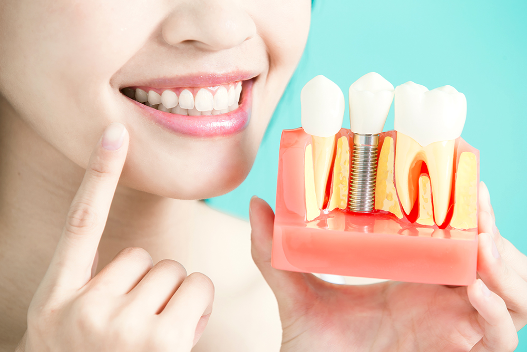 Sameday Dental Implants Clinic Dubai سيمداي لزراعة الأسنان